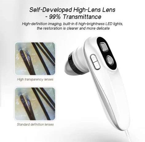 Digital Scalp & Hair Microscope / Analyzer