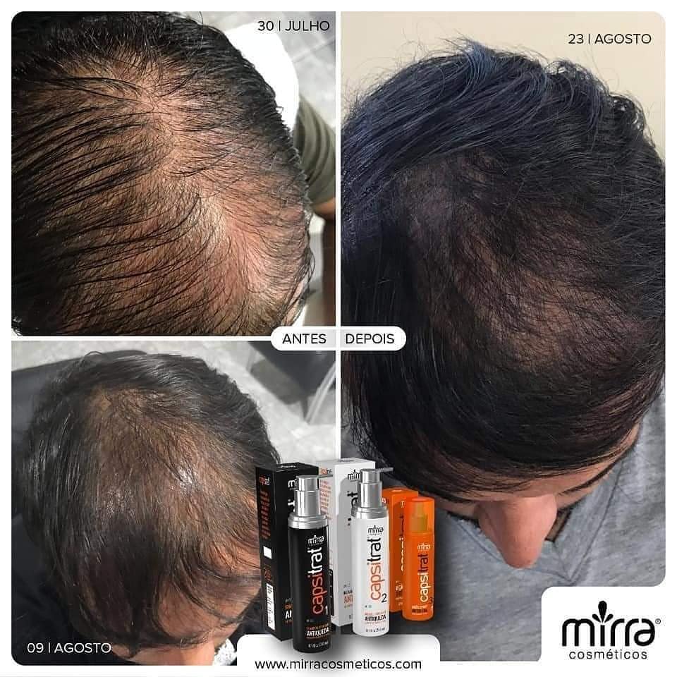 KIT CAPSITRAT (Steps 1 ,2 and 3)