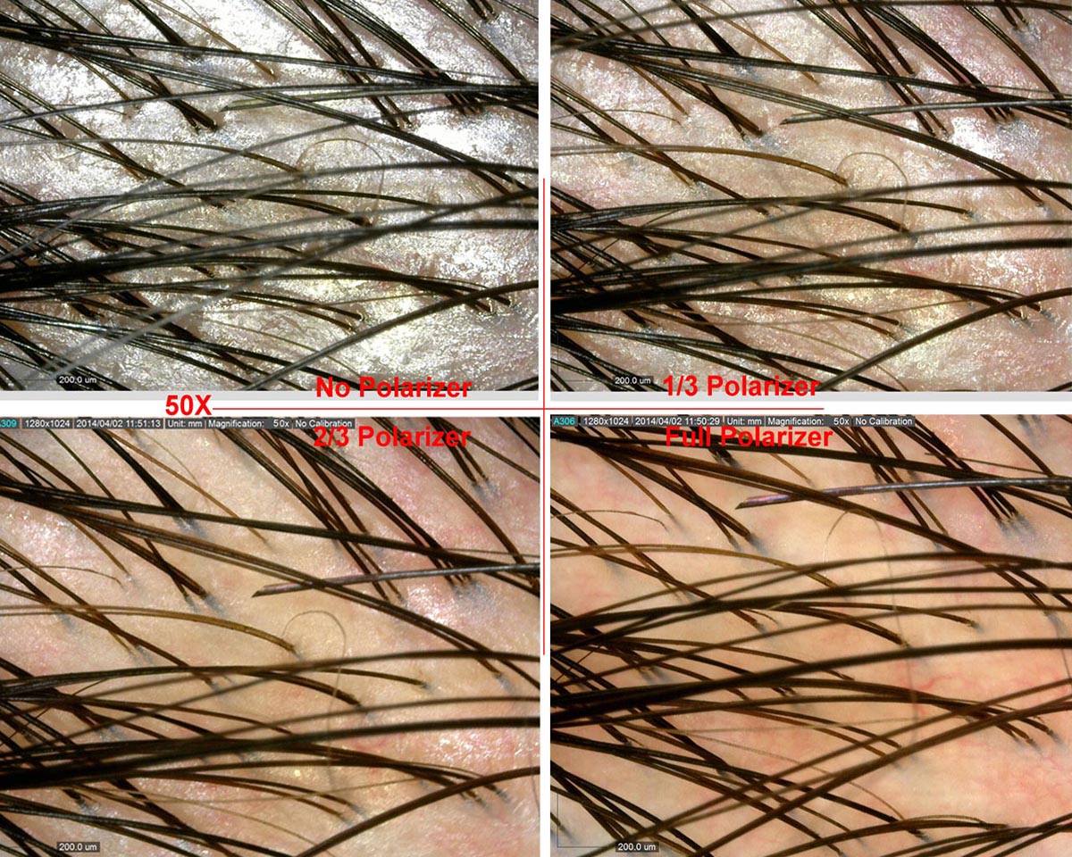 Digital Scalp & Hair Microscope / Analyzer